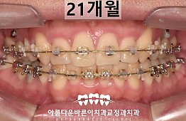 수술후