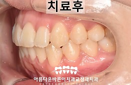 수술후