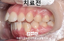 수술전