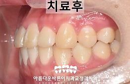 수술후