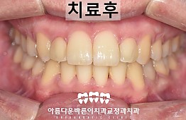 수술후