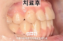 수술후