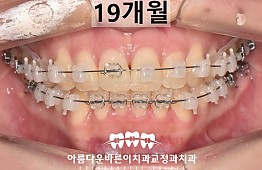 수술후