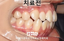 수술전