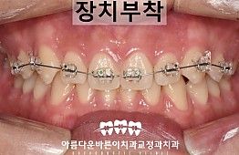 수술후