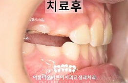 수술후