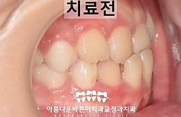 수술전