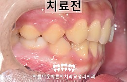 수술전