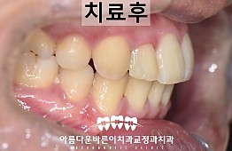 수술후