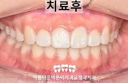 수술후