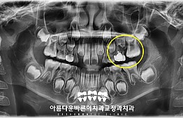 수술후