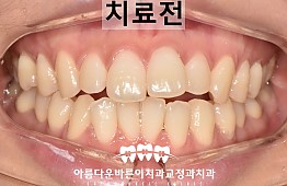 수술전