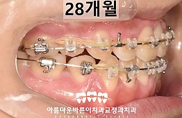 수술후