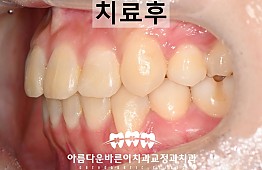 수술후