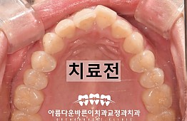 수술전