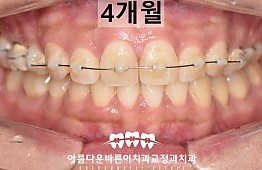 수술후