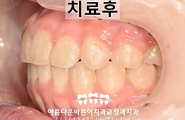 수술후