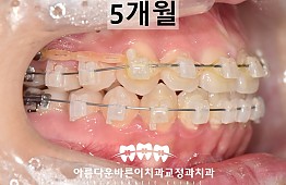 수술후