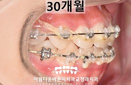 수술후