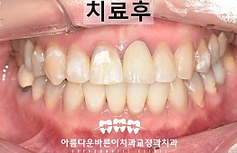 수술후