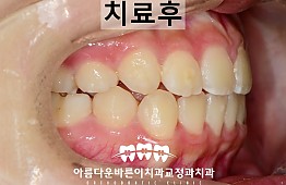 수술후