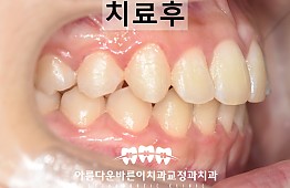 수술후