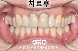 수술후