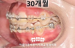 수술후