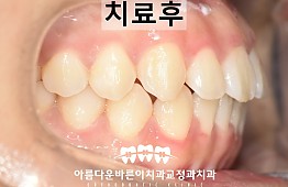 수술후