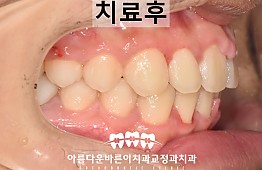 수술후