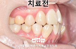 수술전