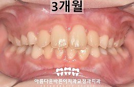 수술후