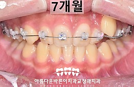 수술후