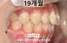 수술후