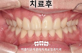 수술후