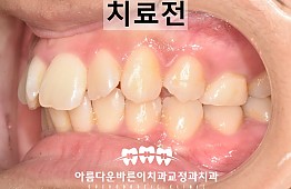 수술전