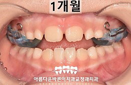 수술후