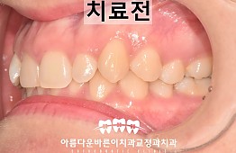 수술전