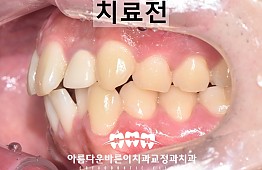 수술전