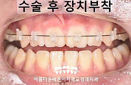 수술전