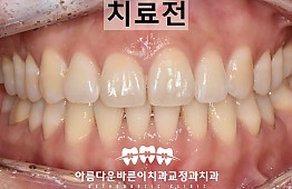 수술전