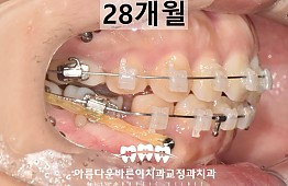 수술후