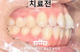 수술전