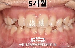 수술후