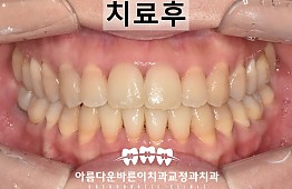 수술후