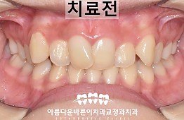 수술전