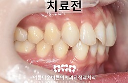 수술전