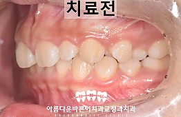 수술전