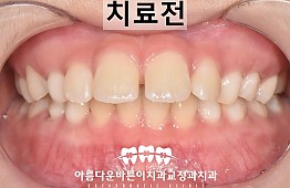 수술전