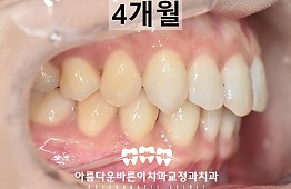 수술후